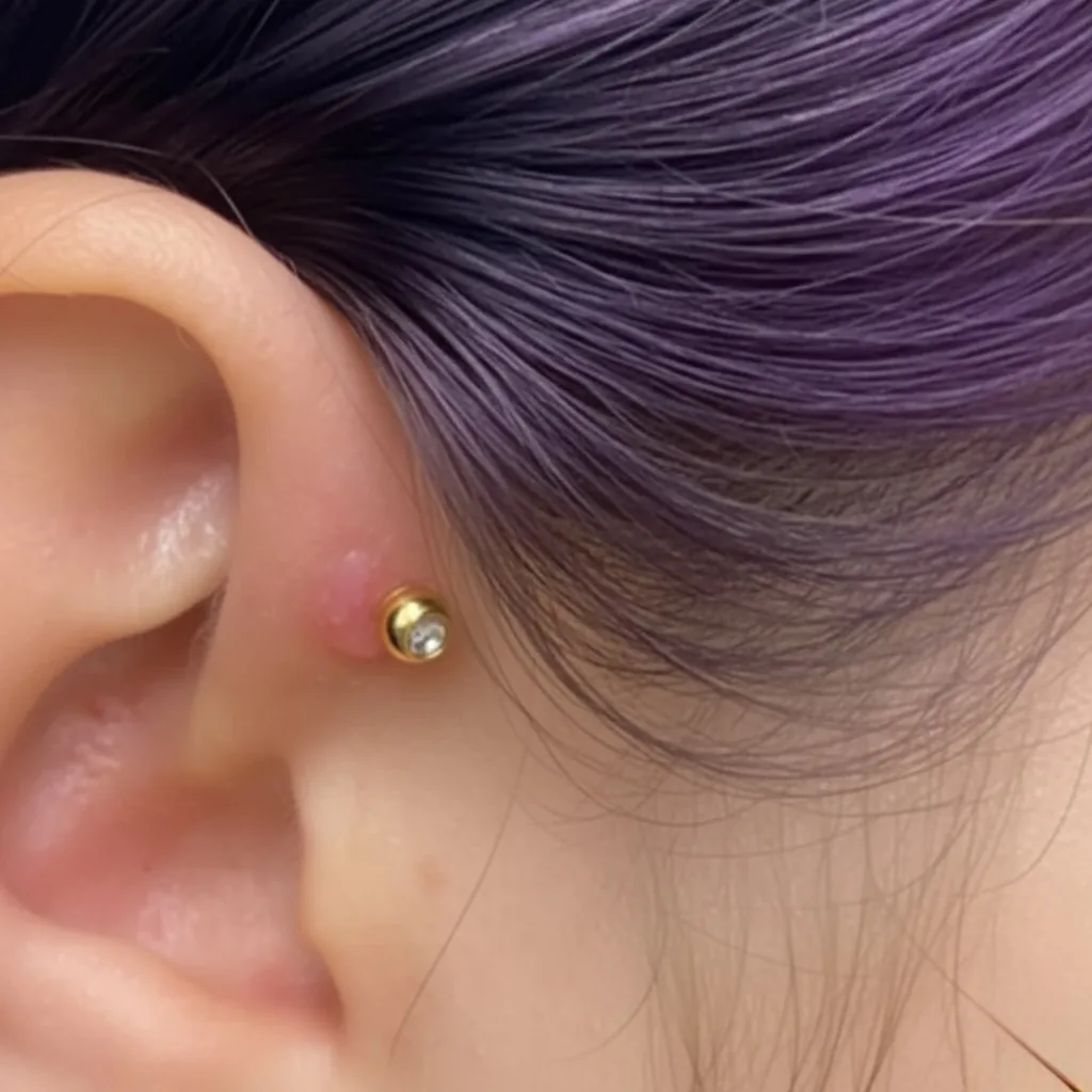 Chéloïde piercing oreille boule cicatrisation Paris Showtime Tattoo